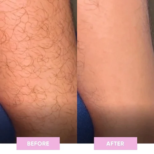 ✨New product Sales - 40% Off -The Silk Razor - Image 9