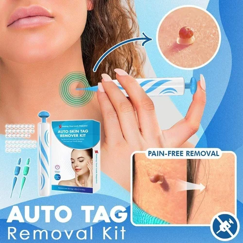 Auto Tag Rapid Removal Kit