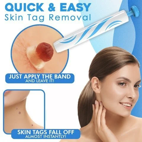 Auto Tag Rapid Removal Kit - Image 2