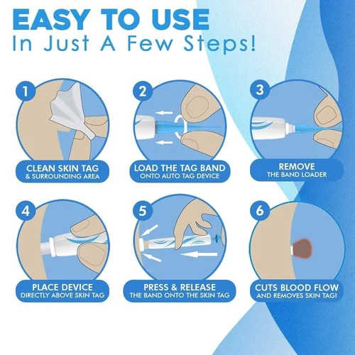 Auto Tag Rapid Removal Kit - Image 8