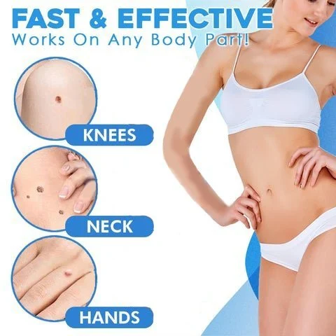 Auto Tag Rapid Removal Kit - Image 7