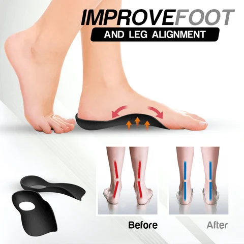 Flat Foot Orthopedic Insoles - Image 5