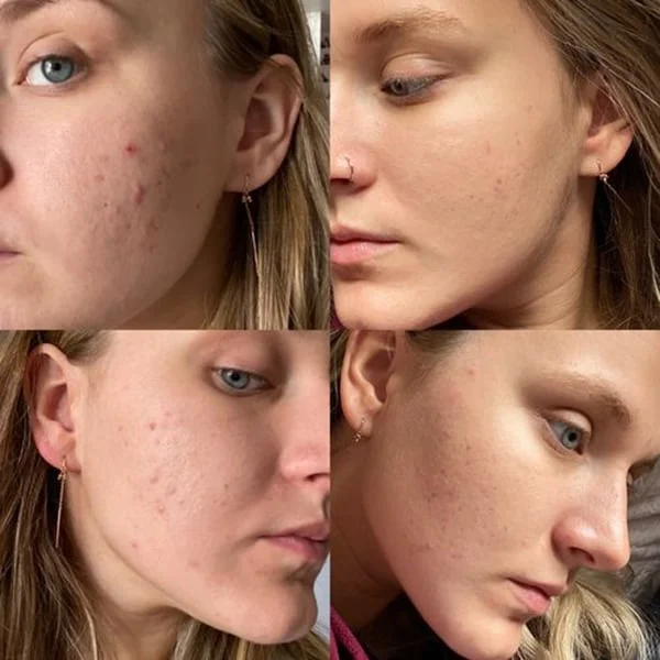 🎄Early Christmas Sale-Non-Porous Deep Cleansing Mask Stick - Image 11