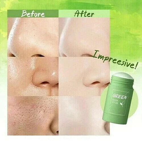 🎄Early Christmas Sale-Non-Porous Deep Cleansing Mask Stick - Image 8