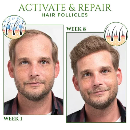 Regrowth Hair Spray – KORTIN - Image 4