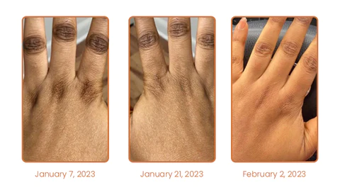 NigriCare™ Therapy Oil - Image 11