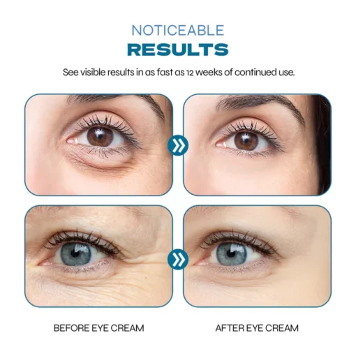 EyeJuvenate Collagen Niacinamide Eye Cream - Image 3