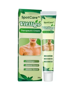 Vitiligo Therapeutic Cream