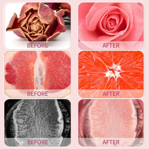 Best Anniecare® Instant Anti-Itch Detox Slimming Products - Image 8