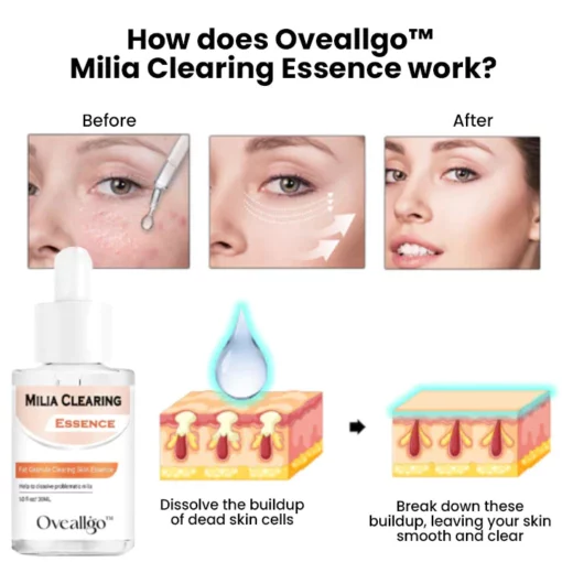Oveallgo™ Milia Clearing Essence - Image 8