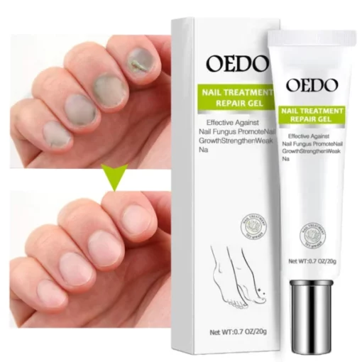 OEDO™Nail Repair Treatment Gel