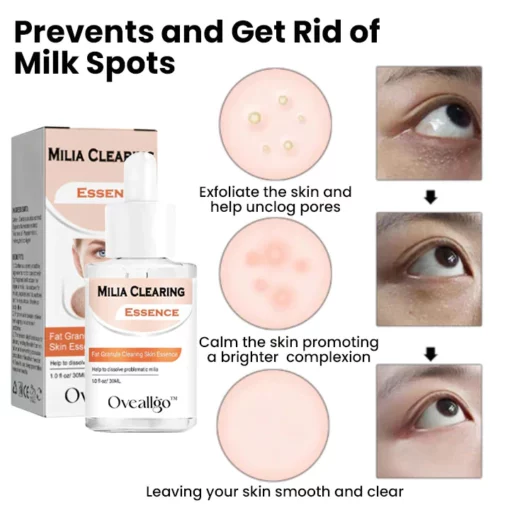 Oveallgo™ Milia Clearing Essence - Image 7