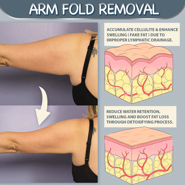 Armpit Fat Removal Lymphatic Pad - Image 6