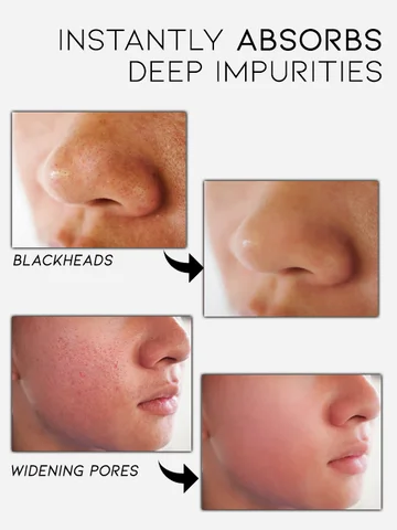 Maskiss™ Herbal Peel Off Mask - Image 8