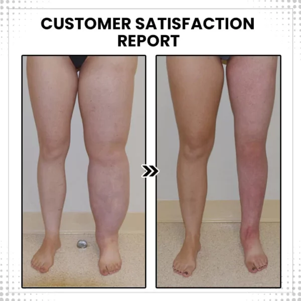 Oveallgo™Lymphvity Thermotherapeutic Body Detox Ring - Image 8