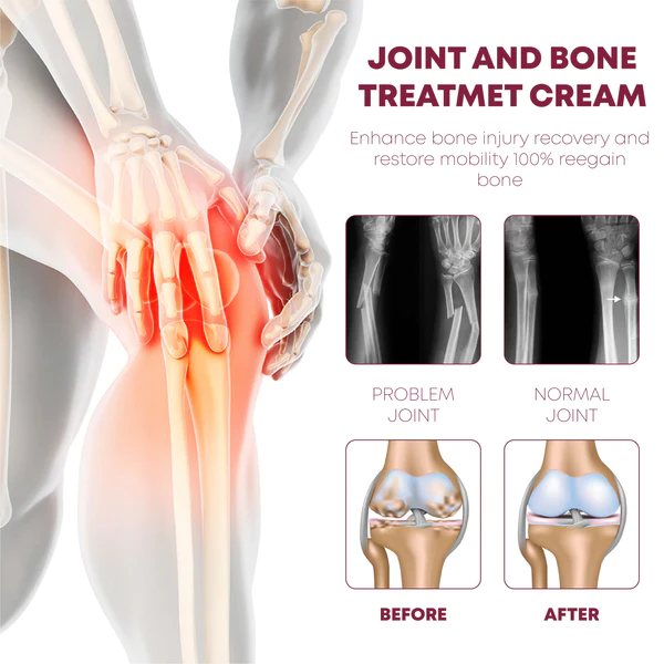 ATTDX ProRelief JointRecovery TherapyCream - Image 5