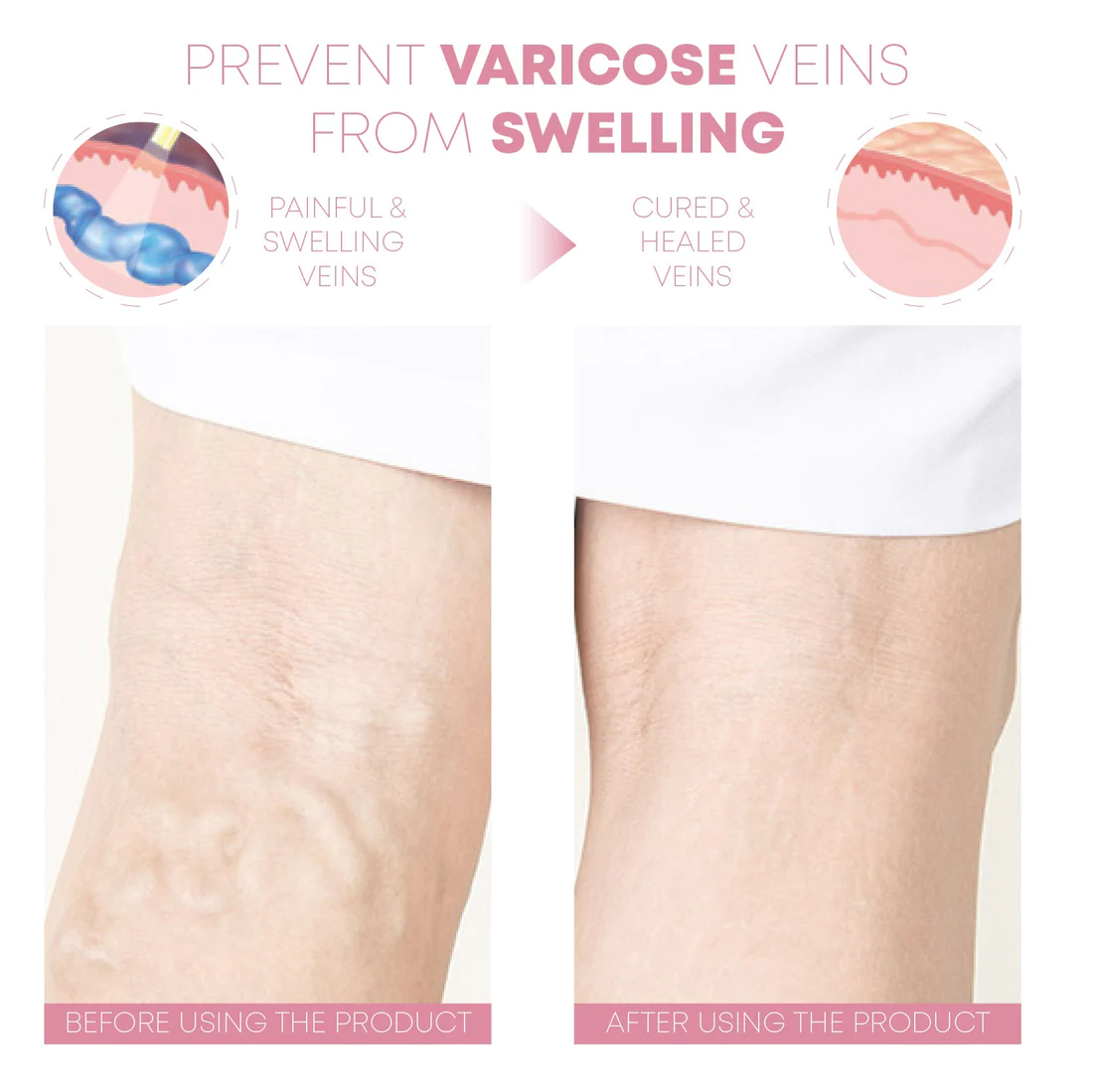 TENS AcupointTheropie SlimMassager Mat - Image 6