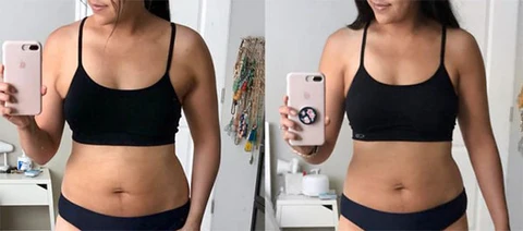 Armpit Fat Removal Lymphatic Pad - Image 3