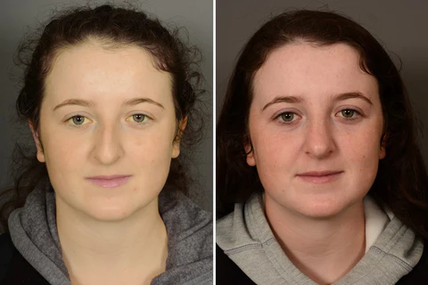 AEXZR™ Liver Meds Foot Patch - Image 8