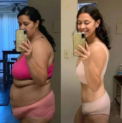 Best Anniecare® Instant Anti-Itch Detox Slimming Products - Image 4