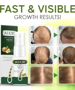 AEXZR™ Hair Regrowth Ginger Spray