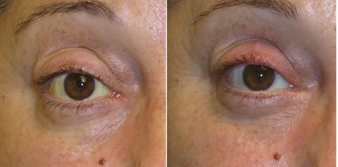 AEXZR™ Liver Meds Foot Patch - Image 7