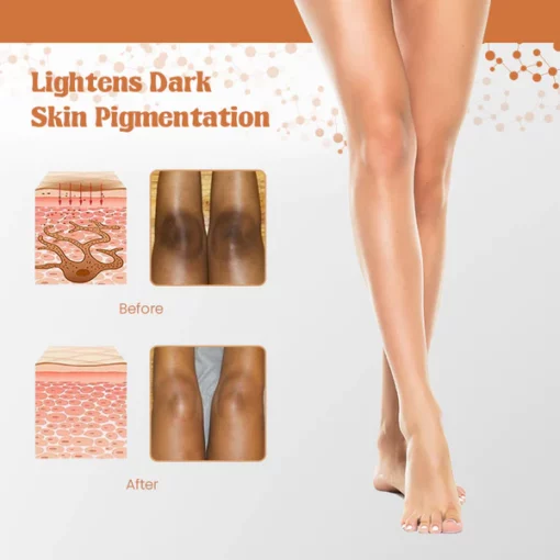 NigriCare™ Therapy Oil - Image 4