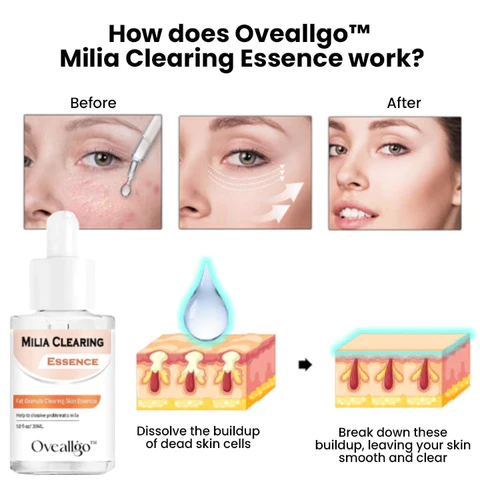 Oveallgo™ Milia Clearing Essence - Image 3