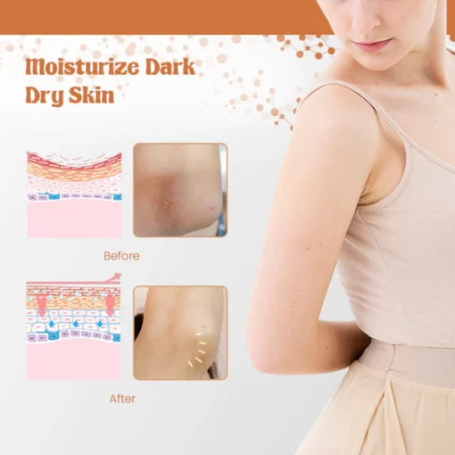 NigriCare™ Therapy Oil - Image 5