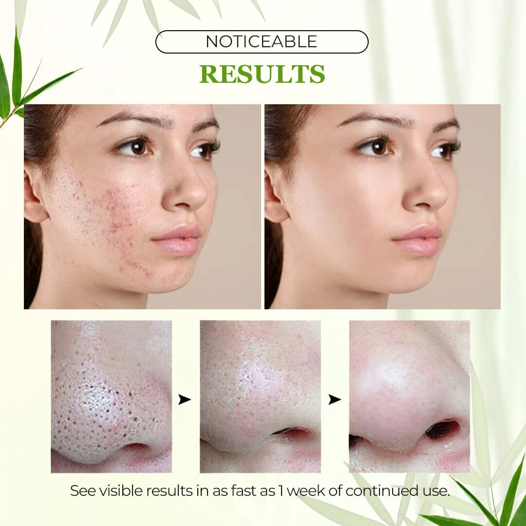 BlackDiamond™ Active Charcoal Deep Cleanse Mask Stick - Image 3