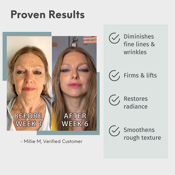 Fivfivgo™ Luxury Collegan Boost Hyaluronsäure-Anti-Aging-Serum - Image 8