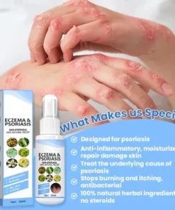 Herbal Psoriasis Relief Spray