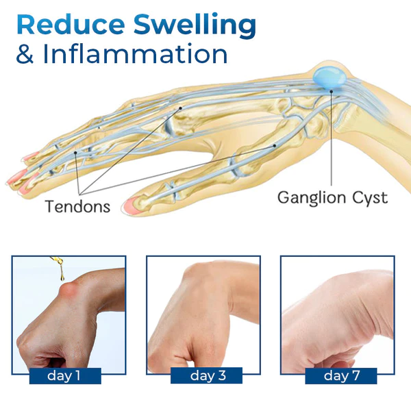 GFOUK™ Deutsches Handgelenkssehnenentzündungs-Therapieöl - Image 7