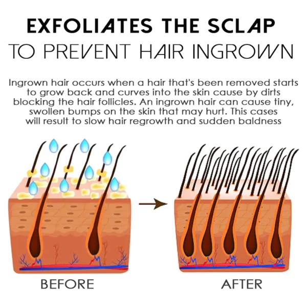 ATTDX HairReborn Minoxidil Growth Roller - Image 7