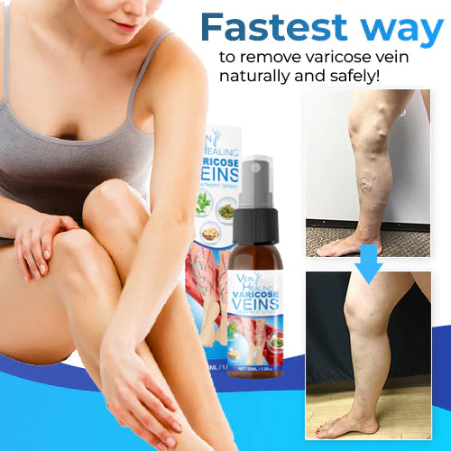 Veinhealing Varicose Veins Treatment Spray - Image 3