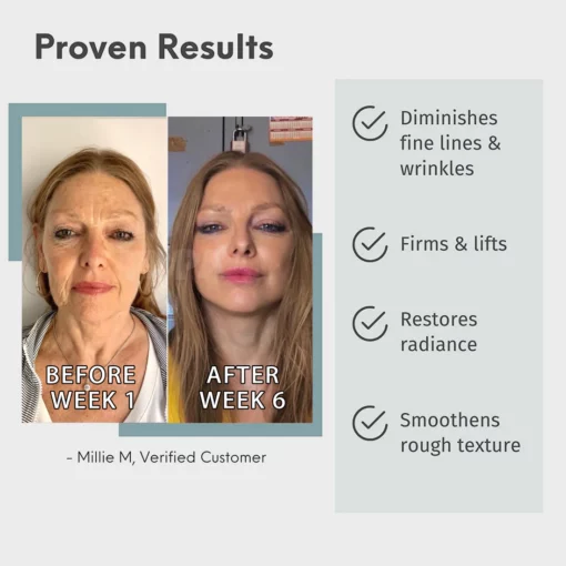 TLOPA® Luxury Hyaluronic Acid Anti-Aging Serum - Image 5