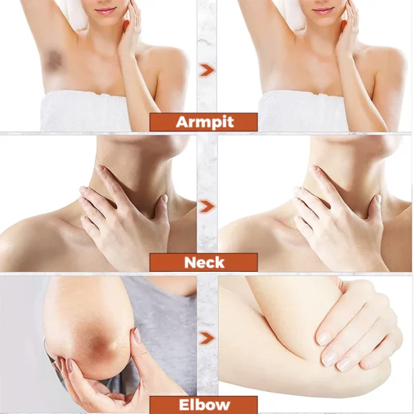 GFOUK™ AcanthoClear Therapy Spray - Image 3