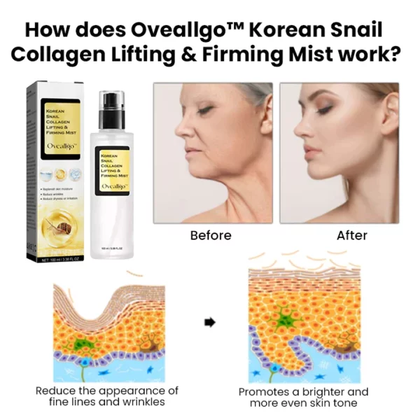 Oveallgo™ Korean Snail Collagen Lifting & Firming Mist - Image 5