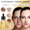 TLOPA Blemish Treatment serum