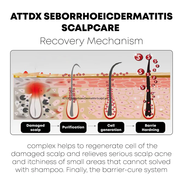 ATTDX SeborrhoeicDermatitis ScalpCare TreatmentCream - Image 7