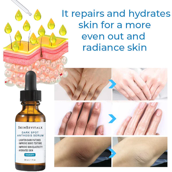 SkinRevitalx® Acanthosis Nigricans Therapy Serum - Image 7