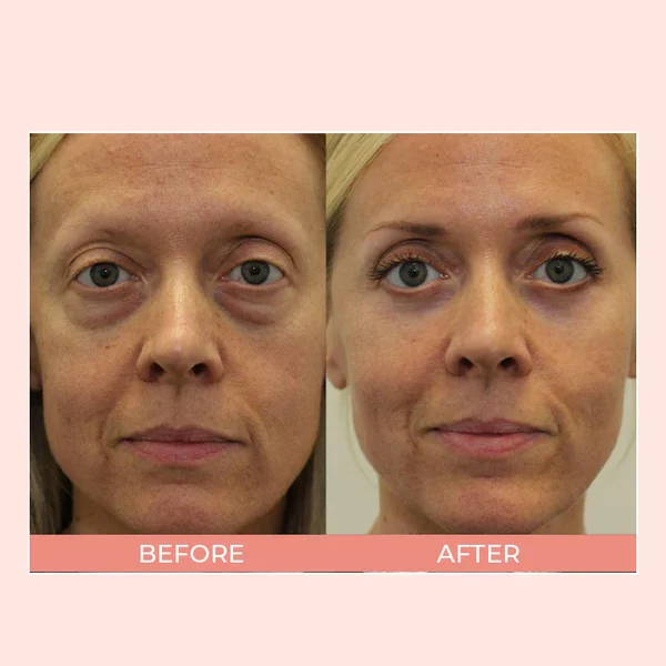 Retinol Polypeptide Repair Eye Cream - Image 8