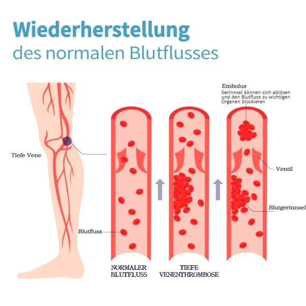 KNEECA Tourmaline Selbstheizende Kniehülse - Image 5