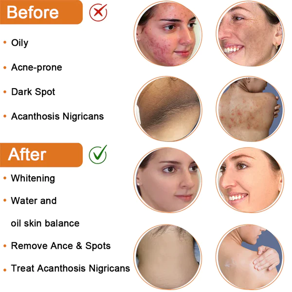 CC™ Cleansing Lotion for Acne & Spots & Acanthosis Nigricans - Image 5