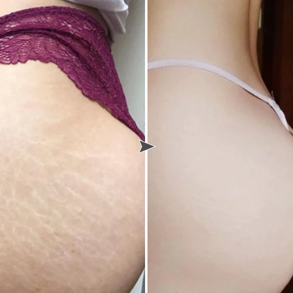 PASTEL Anti-Cellulite Slimming Cream - Image 5