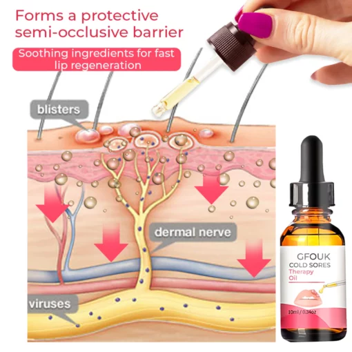 GFOUK™ Cold Sores Therapy Oil - Image 7