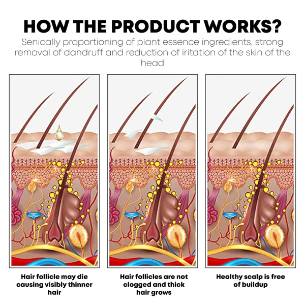 ATTDX SeborrhoeicDermatitis ScalpCare TreatmentCream - Image 6