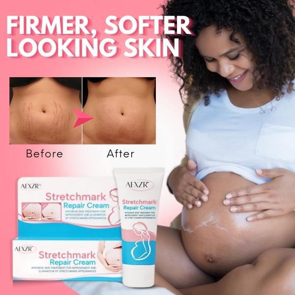 AEXZR™ Stretchmark Repair Cream - Image 7