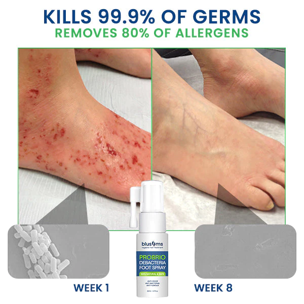 Blusoms™ PROBRIO Debacteria Foot Spray - Image 7