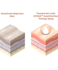 BlackDiamond™ Active Charcoal Deep Cleanse Mask Stick